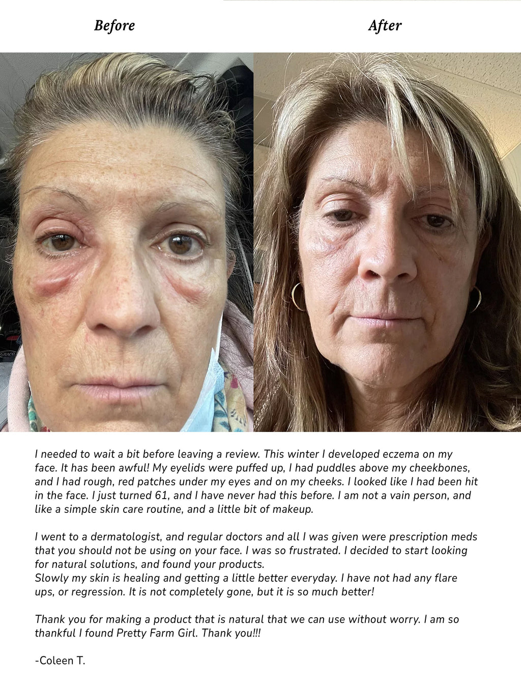 Pure + Simple Skin Kit for Sensitive Skin